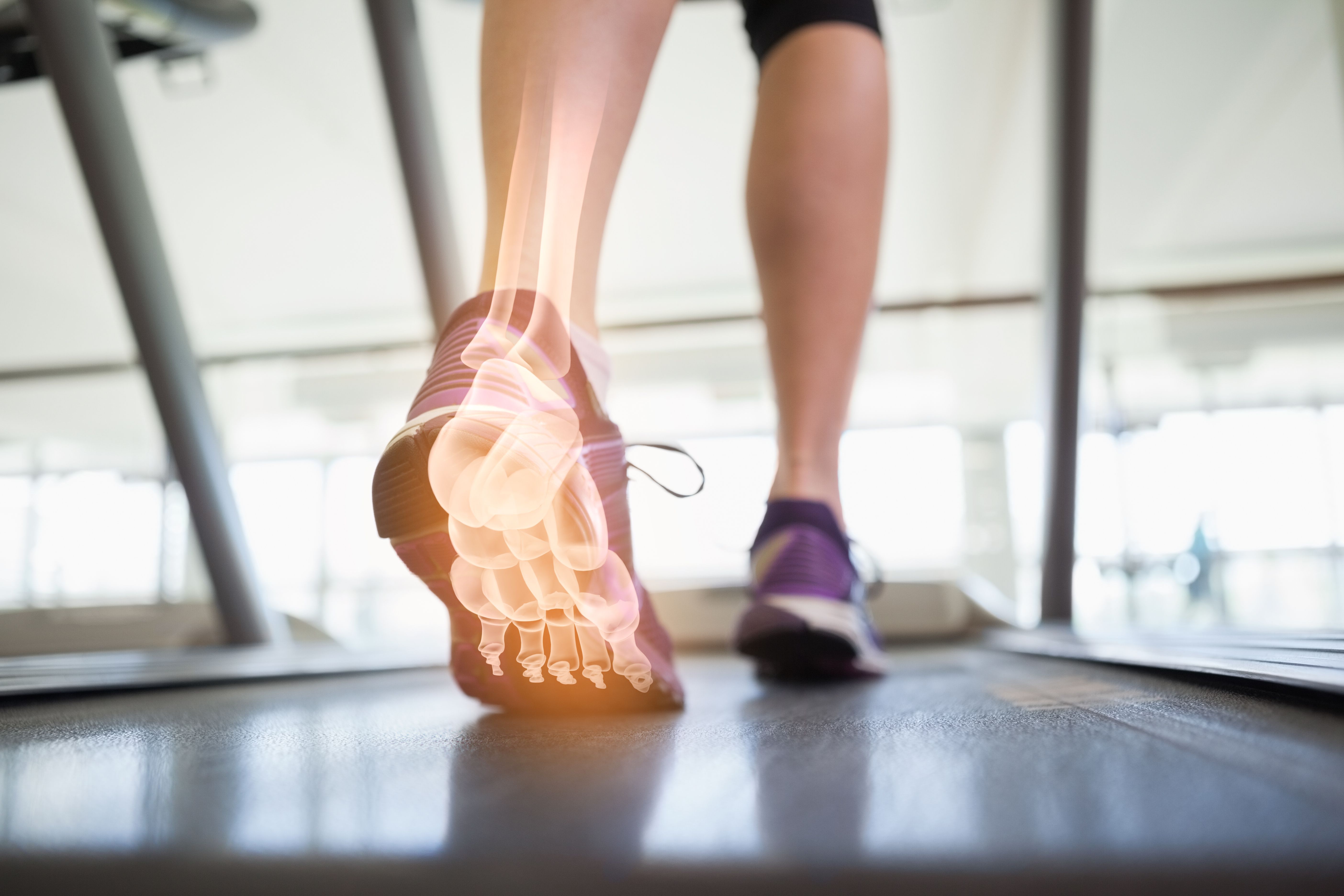 Podologia dello sport — studio podologico Bologna